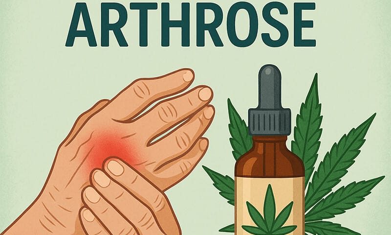 CBD et arthrose - Le CBD Marseillais